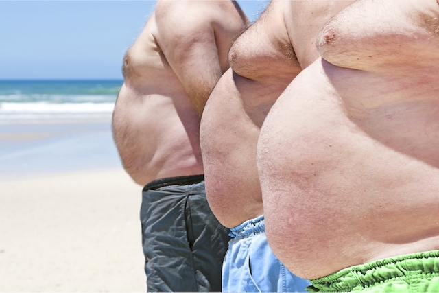 Dia Mundial da Obesidade: Brasil tem 30 milhões de adultos obesos