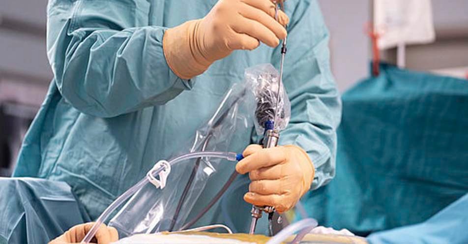 HUSF realiza primeira cirurgia endoscópica de coluna