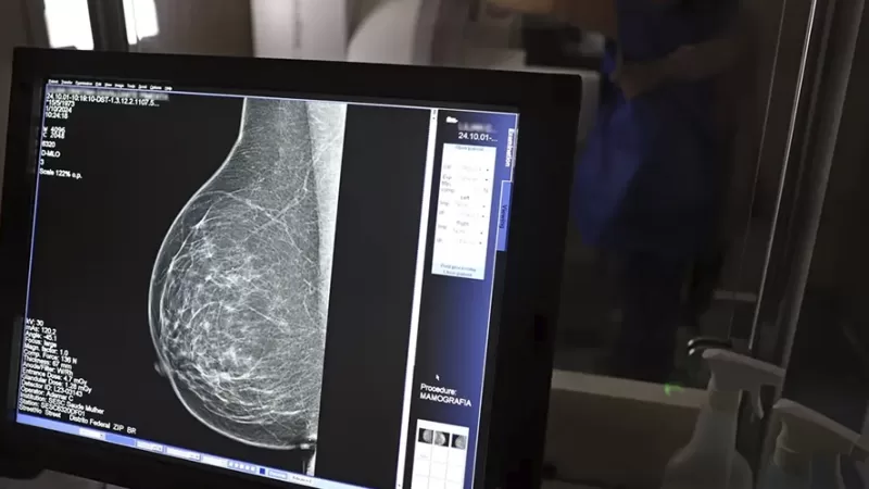 Bragança supera meta de mamógrafos, mas pós-diagnóstico é desafio
