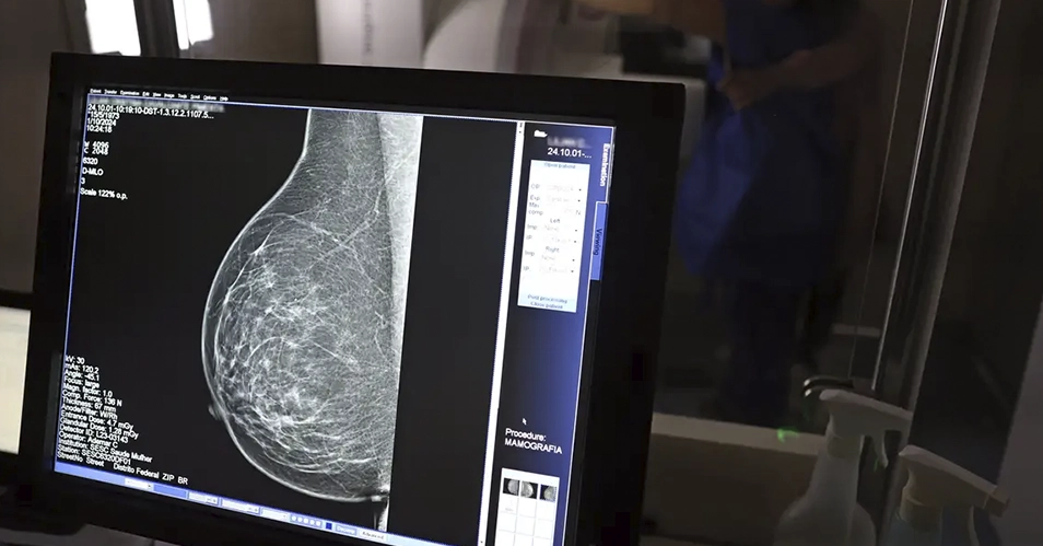 Bragança supera meta de mamógrafos, mas pós-diagnóstico é desafio
